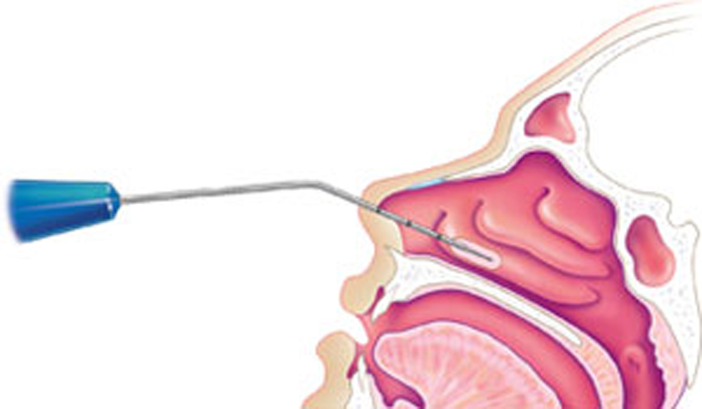 Amenuisement des Clinique du sommeil Dormalab