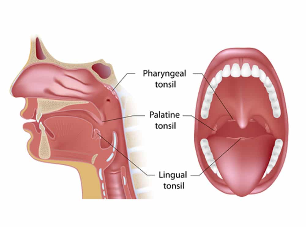 Dorma Chirurgie maxillo faciale amygdalectomie